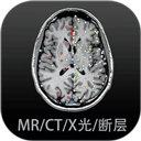 免费短剧随心看